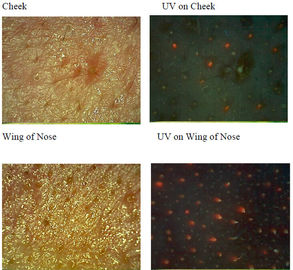 Máquina ultravioleta facial del analizador de la piel para la piel Mositure/grasa/arruga/pigmentación