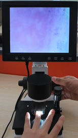 Coloree los pixeles capilares del microscopio 380000 del equipo de la microcirculación del repliegue del dermis con CE